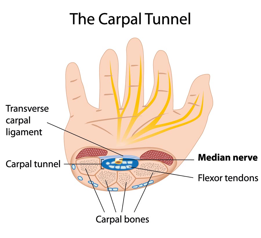 The Carpal Tunnel