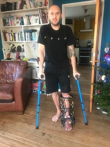 Tom on crutches