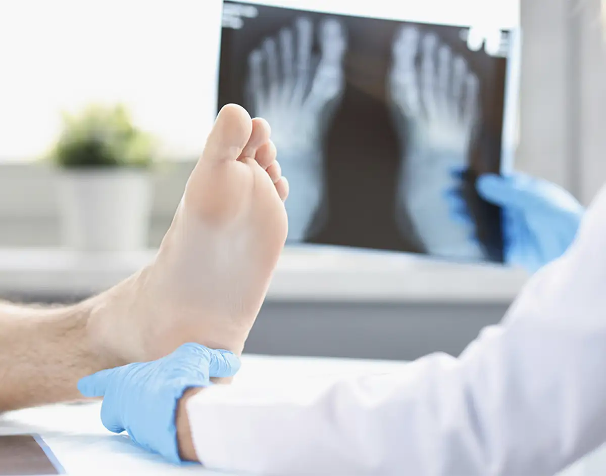 Cheilectomy-Arthritis-Surgery-Clinic