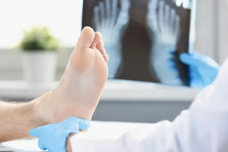 Conditions-Bone-Infection